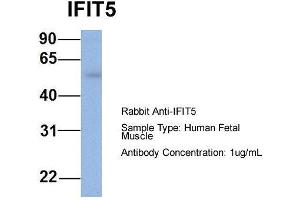 Host: Rabbit  Target Name: IFIT5  Sample Tissue: Human Fetal Muscle  Antibody Dilution: 1. (IFIT5 anticorps  (Middle Region))