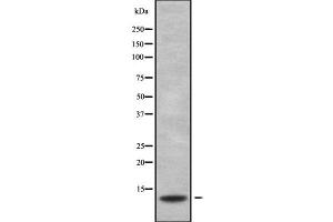 Western blot analysis S100G using HeLa whole cell lysates (S100G anticorps  (Internal Region))