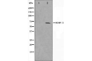Western blot analysis on A549 cell lysate using MMP11 Antibody.