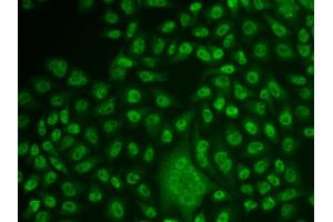 Immunofluorescence analysis of U2OS cells using TFPT antibody. (TFPT anticorps)