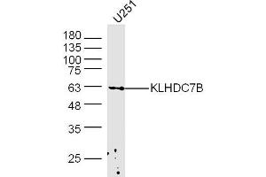 U251 lysates probed with KLHDC7B Polyclonal Antibody, Unconjugated  at 1:300 dilution and 4˚C overnight incubation.