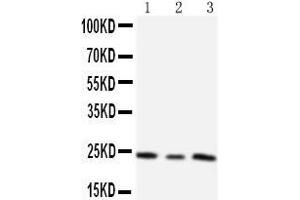 Anti-TIMP4 antibody,  Western blotting Lane 1:  Cell Lysate Lane 2: HELA Cell Lysate Lane 3: SMMC Cell Lysate (TIMP4 anticorps  (C-Term))