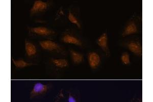 Immunofluorescence analysis of U-2 OS cells using P90RSK Polyclonal Antibody at dilution of 1:100. (RPS6KA3 anticorps)