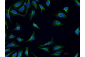 Immunofluorescence of monoclonal antibody to FPR2 on HeLa cell.