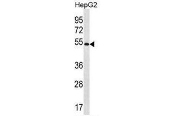 MGAT4C anticorps  (C-Term)