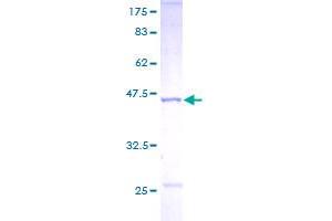 Non-Metastatic Cells 1, Protein (NM23A) Expressed in (NME1) (AA 1-152) protein (GST tag)