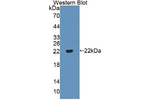 Western blot analysis of the recombinant protein. (ADAMTS13 anticorps  (AA 682-859))