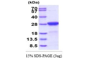 SDS-PAGE (SDS) image for Adenylate Kinase 1 (AK1) (AA 1-210) (Active) protein (His tag) (ABIN7529381) (Adenylate Kinase 1 Protein (AK1) (AA 1-210) (His tag))