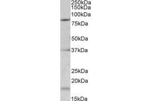 Western Blotting (WB) image for anti-Potassium Voltage-Gated Channel, Shaw-Related Subfamily, Member 3 (KCNC3) (Internal Region) antibody (ABIN2465018) (KCNC3 anticorps  (Internal Region))