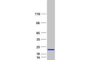 Validation with Western Blot