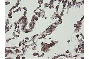 Image no. 7 for anti-PHD Finger Protein 7 (PHF7) (AA 155-381) antibody (ABIN1490975)