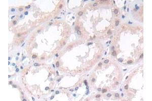 DAB staining on IHC-P; Samples: Human Kidney Tissue (APLP2 anticorps  (AA 607-852))