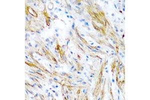 Immunohistochemistry of paraffin-embedded human colon using LMOD1 antibody at dilution of 1:200 (40x lens). (Leiomodin 1 anticorps)
