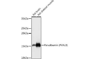 Western blot analysis of extracts of various cell lines, using Parvalbumin (PVALB) antibody (ABIN6128526, ABIN6146506, ABIN6146507 and ABIN6217573) at 1:1000 dilution. (PVALB anticorps  (AA 1-110))