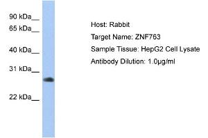 Host: Rabbit Target Name: ZNF763 Sample Type: HepG2 Whole cell lysates Antibody Dilution: 1. (ZNF763 anticorps  (C-Term))