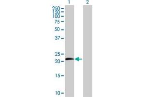 Western Blot analysis of BTC expression in transfected 293T cell line by BTC MaxPab polyclonal antibody. (Betacellulin anticorps  (AA 1-178))