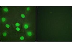 Immunofluorescence analysis of HuvEc cells, using GATA4 (Ab-262) Antibody. (GATA4 anticorps  (AA 228-277))