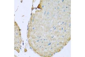 Immunohistochemistry of paraffin-embedded mouse heart using TMEM173 antibody.