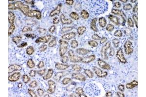 IHC testing of FFPE rat kidney tissue with RBP4 antibody at 1ug/ml.