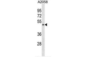 BFAR Antibody (N-term) western blot analysis in A2058 cell line lysates (35µg/lane). (BFAR anticorps  (N-Term))