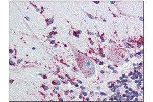 Immunohistochemistry (IHC) image for anti-Cathepsin D (CTSD) (AA 21-412) antibody (ABIN317502) (Cathepsin D anticorps  (AA 21-412))