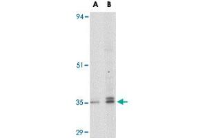 Western blot analysis of GPR3 in EL4 cell lysate with GPR3 polyclonal antibody  at (A) 1 and (B) 2 ug/mL . (GPR3 anticorps  (C-Term))