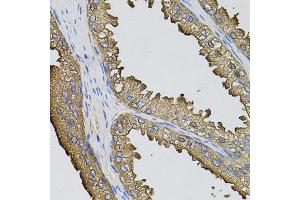 Immunohistochemistry of paraffin-embedded human prostate using SUMO3 antibody (ABIN5971585) (40x lens). (SUMO3 anticorps)