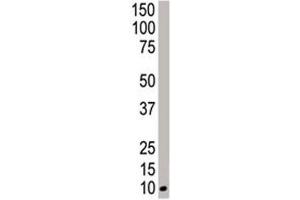Western blot analysis of NEDD8 antibody and HeLa cell lysate
