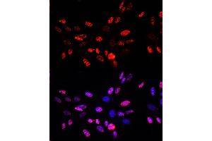 Immunofluorescence analysis of NIH-3T3 cells using Phospho-Histone H3-T45 Rabbit pAb (ABIN7267692) at dilution of 100 (40x lens).