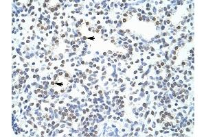 POGZ antibody was used for immunohistochemistry at a concentration of 4-8 ug/ml to stain Alveolar cells (arrows) in Human Lung. (POGZ anticorps  (N-Term))