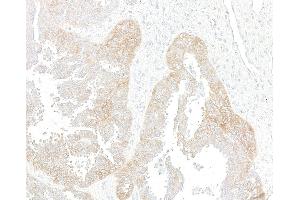 Immunohistochemistry (IHC) image for anti-Met Proto-Oncogene (MET) (C-Term) antibody (ABIN7795683) (Recombinant c-MET anticorps  (C-Term))