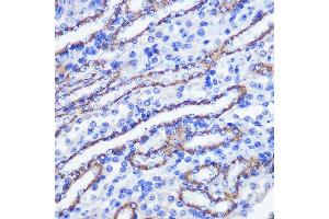 Immunohistochemistry of paraffin-embedded mouse kidney using PHLPP1 Rabbit pAb (ABIN6128434, ABIN6145573, ABIN6145574 and ABIN6225035) at dilution of 1:100 (40x lens). (PHLPP1 anticorps  (AA 1508-1717))