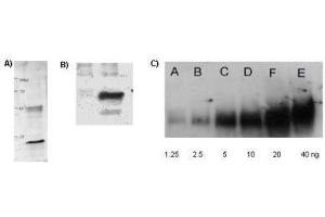 Affinity Purified anti-Acetylated Lysine (AcK) antibody is shown to detect acetylated histone in TSA-treated mouse spleen cell lysate (Panel A); control (left lane) and TSA-treated mouse spleen cell lysate (right lane) in panel B; and in acetylated BSA loaded as indicated (panel C).