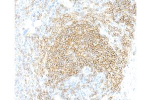 Immunohistochemistry (IHC) image for anti-CD19 Molecule (CD19) (AA 19-287) antibody (ABIN7455123) (Recombinant CD19 anticorps  (AA 19-287))