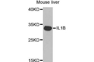 Western Blotting (WB) image for anti-Interleukin 1, beta (IL1B) (AA 1-269) antibody (ABIN3021462)