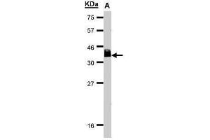 WB Image Sample(30 μg of whole cell lysate) A:HeLa S3, 15% SDS PAGE antibody diluted at 1:1000 (BCL7A anticorps  (C-Term))