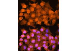 Immunofluorescence analysis of HeLa cells using AIRE Rabbit pAb (ABIN3022514, ABIN3022515, ABIN3022516 and ABIN6218869) at dilution of 1:100.