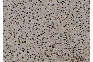ABIN6273137 at 1/100 staining Mouse liver tissue by IHC-P. (MECP2 anticorps  (C-Term))