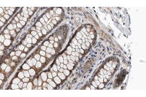 ABIN6276986 at 1/100 staining Rat colon tissue by IHC-P. (TAPBP anticorps  (Internal Region))