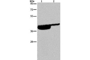 Western Blot analysis of Human bladder and bladder transitional cell carcinoma tissue using P2RX3 Polyclonal Antibody at dilution of 1:250 (P2RX3 anticorps)