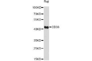 Western blot analysis of extracts of Raji cells, using CD38 Antibody. (CD38 anticorps)