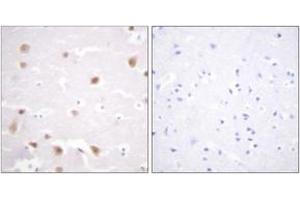 Immunohistochemistry (IHC) image for anti-Casein Kinase 2, beta (CSNK2B) (AA 166-215) antibody (ABIN2888808) (CSNK2B anticorps  (AA 166-215))