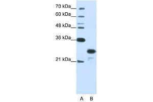 ANP32A antibody used at 1. (PHAP1 anticorps)
