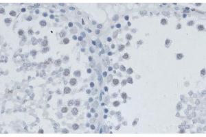 Immunohistochemistry of paraffin-embedded Rat testis using MSH6 Polyclonal Antibody at dilution of 1:100 (40x lens). (MSH6 anticorps)