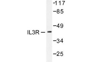 Image no. 2 for anti-Interleukin 3 Receptor, alpha (IL3RA) antibody (ABIN265478) (IL3RA anticorps)