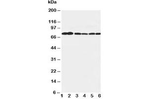 Western blot testing of B Raf antibody and Lane 1:  rat brain (BRAF anticorps  (AA 344-362))