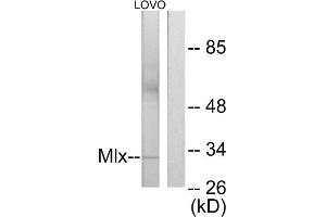 Western blot analysis of extracts from LOVO cells, using Mlx antibody. (MLX anticorps  (Internal Region))