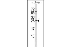 Western blot analysis in mouse liver tissue lysates (35ug/lane). (RAB5B anticorps  (AA 85-112))