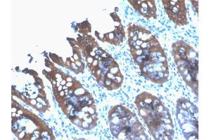 Formalin-fixed, paraffin-embedded human Colon stained with Cytokeratin 8 Mouse Recombinant Monoclonal Antibody (rB22.