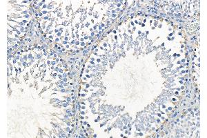 Vimentin mouse monoclonal Antibody at 1/100 staining Rat testis tissue by IHC-P.